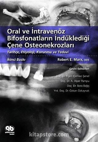 Oral ve İntravenöz Bifosfonatların İndüklediği Çene Osteonekrozları