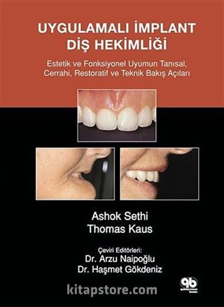Uygulamalı İmplant Diş Hekimliği