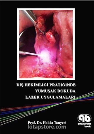 Diş Hekimliği Pratiğinde Yumuşak Dokuda Lazer Uygulamaları