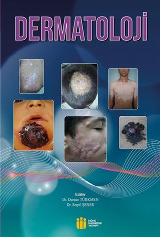 Dermatoloji
