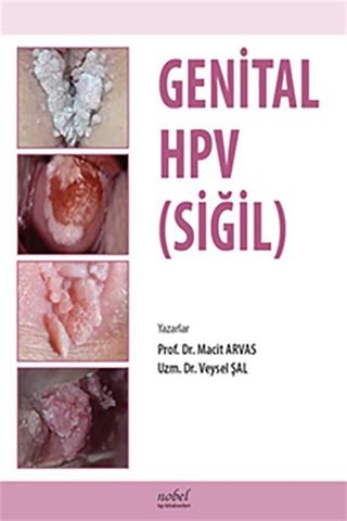 Genital HPV (SİĞİL)