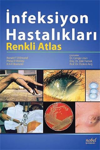 İnfeksiyon Hastalıkları: Renkli Atlas