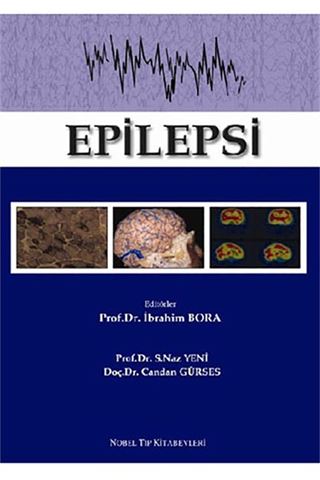 Epilepsi