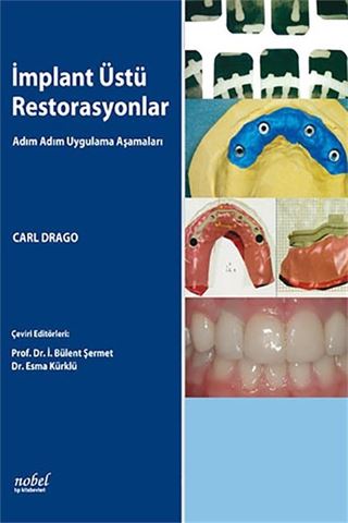İmplant Üstü Restorasyonlar: Adım Adım Uygulama Aşamaları