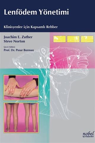 Lenfödem Yönetimi: Klinisyenler için Kapsamlı Rehber