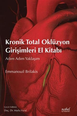Kronik Total Oklüzyon Girişimleri El Kitabı: Adım Adım Yaklaşım
