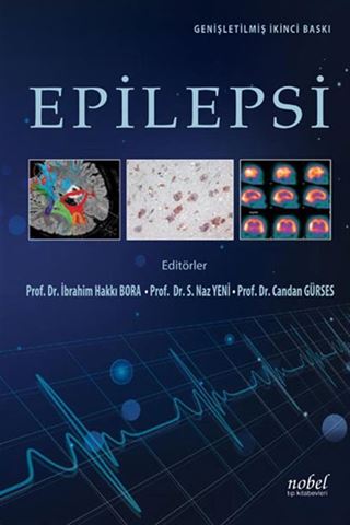Epilepsi: Genişletilmiş İkinci Baskı