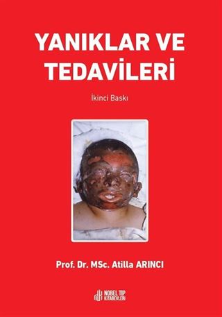 Yanıklar ve Tedavileri 2.Baskı