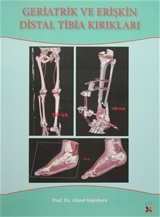 Geriatrik Ve Erişkin Distal Tibia Kırıkları