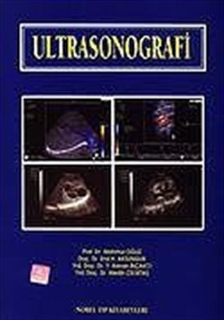 Ultrasonografi