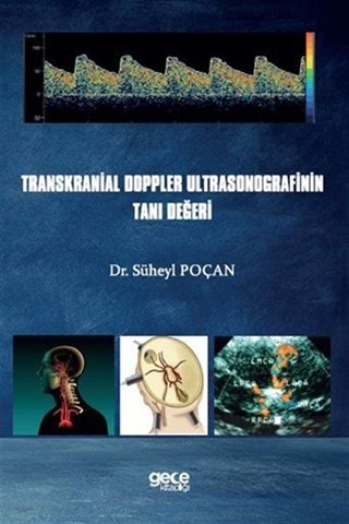 Transkranial Doppler Ultrasonografinin Tanı Değeri