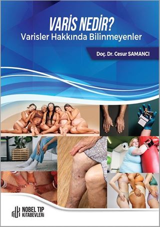 Varis Nedir ? Varisler Hakkında Bilinmeyenler