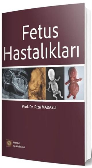 Fetus Hastalıkları