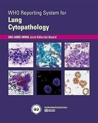 Who Reporting System For Lung Cytopathology (who R