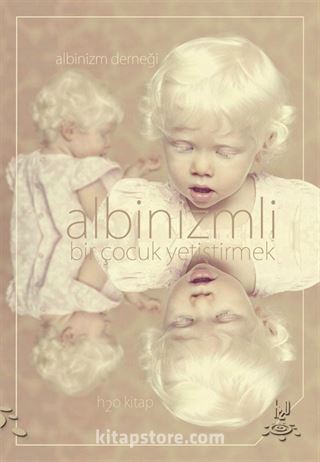 Albinizmli Bir Çocuk Yetiştirmek