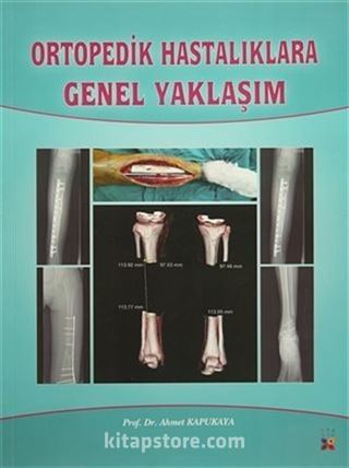 Ortopedik Hastalıklara Genel Yaklaşım