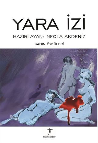 Yara İzi