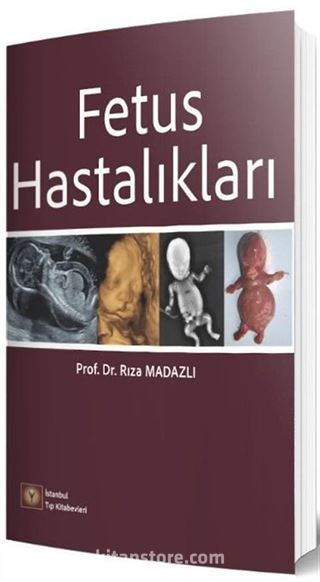 Fetus Hastalıkları
