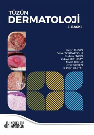 Tüzün Dermatoloji 4.Baskı