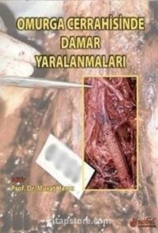 Omurga cerrahisinde Damar yaralanmaları