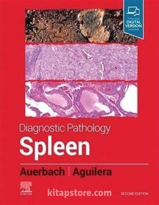 Diagnostic Pathology: Spleen, 2nd Edition