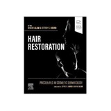 Procedures in Cosmetic Dermatology: Hair Restorati